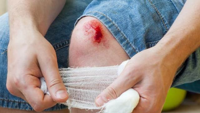 چرا زخم‌های کوچک را نباید نادیده گرفت؟